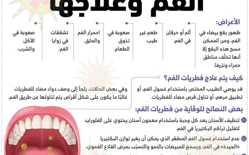 أعراض فطريات الفم وعلاجها