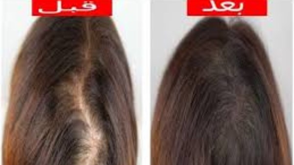 ماذا يحدث لشعرك عند استخدام ماسك الليمون؟