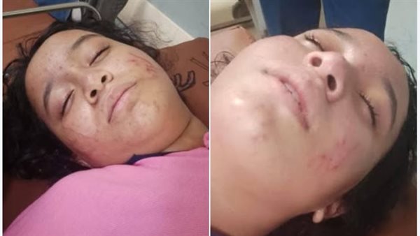 عاجل| ضربوها بالعصيان.. تفاصيل الاعتداء على طالبة إعدادي في مدرسة بالهرم