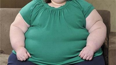 هل العالم على أعتاب«ثورة علاجية للسمنة والسكر النوع الثاني»؟