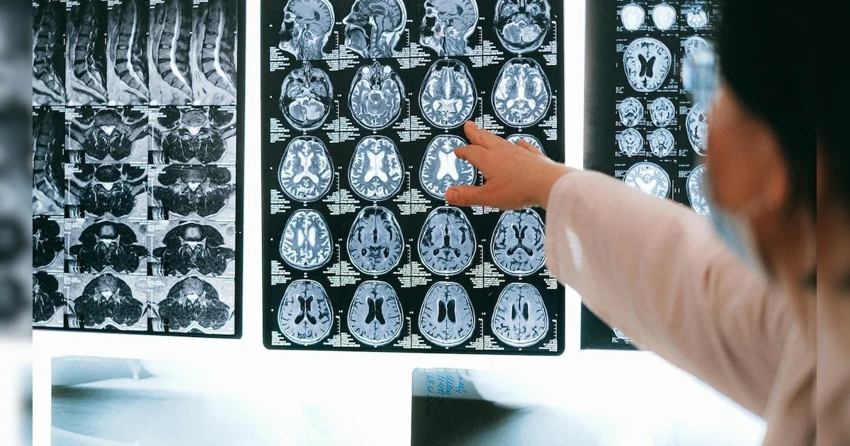 الهند.. 19 حالة وفاة بسبب الأميبا آكلة الدماغ والسلطات تتأهب