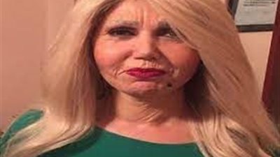 بسبب حقنة غير معقمة.. ميسرة تكشف عن تعرضها لأزمة صحية عقب عملية تجميل