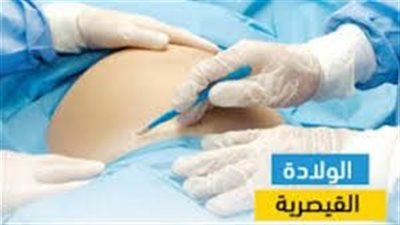 معدلات وفيات الأمهات 25 لكل 100 ألف.. متحدث الصحة يكش أضرار الولادة القيصرية