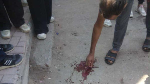 بالصور|تفاصيل مشاجرة دموية داخل مدرسة بالمعصرة.. ومطالب بتدخل التعليم