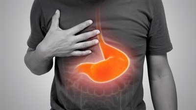 15 علاجًا منزليًا طبيعيًا للحموضة وارتجاع المريء وحرقة المعدة