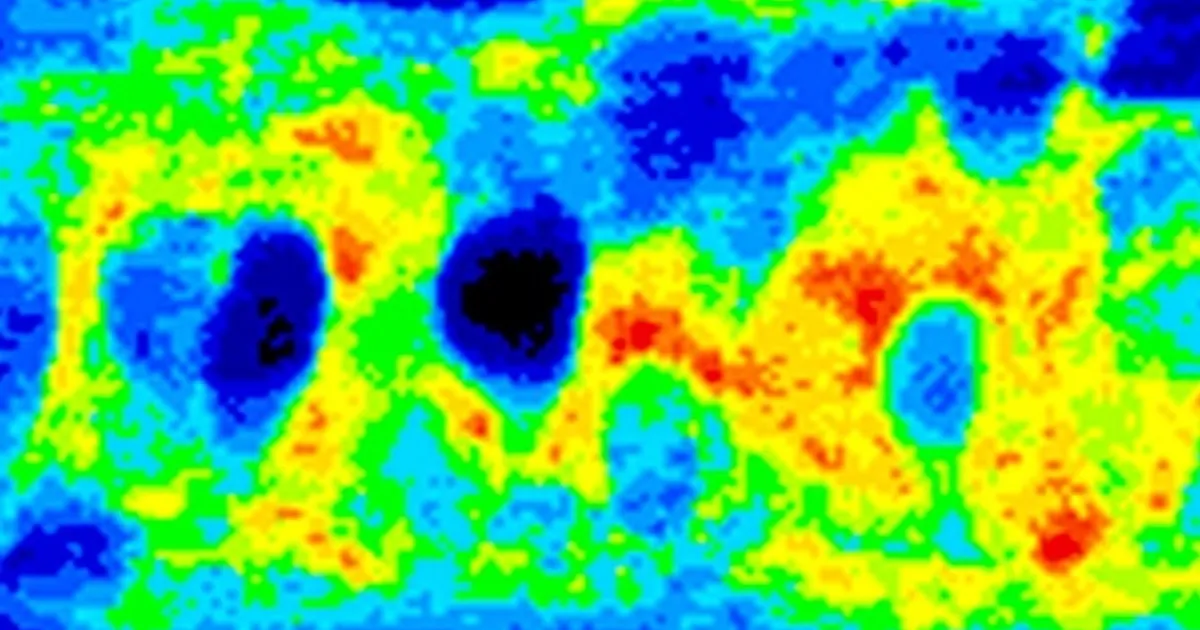 مرض التصلب الجانبي الضموري.. لماذا يعجز المرضى عن الحركة؟