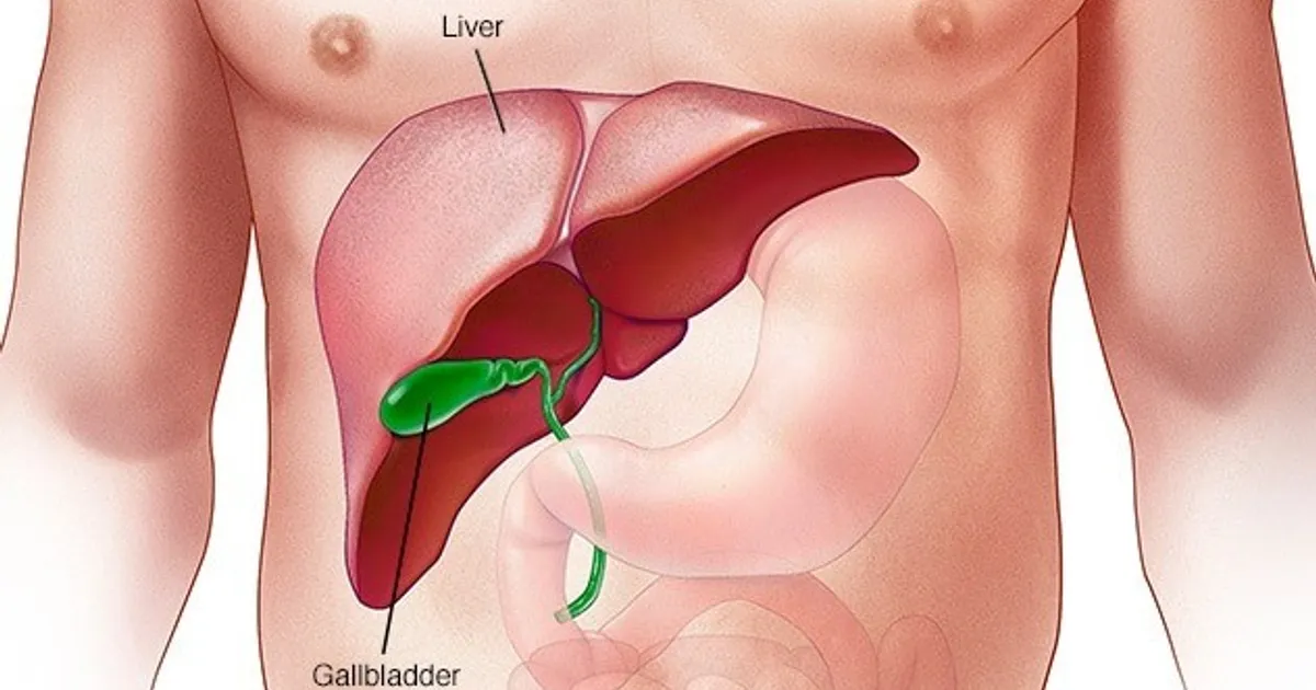 المشروبات قليلة السكر المحليات الصناعية مرض الكبد الدهني