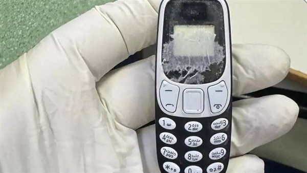 عاجل|ظل داخله 11 شهرا.. استخراج هاتف محمول من بطن مريض بجامعة المنصورة