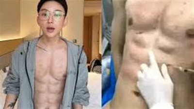 هوس الفورمة.. مؤثر دفع صف مليون دولار لصناعة عضلات وهمية