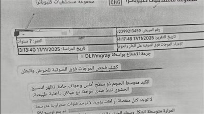 انقطاع مفاجئ فى الكهرباء.. الحقيقة الكاملة حول واقعة سقوط طفلة داخل مدرسة النصر للغات بالنزهة