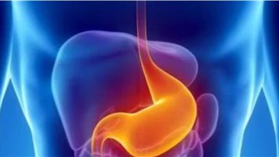 5 علامات مبكرة لسرطان المعدة قد تمرّ دون ملاحظة وتحذر الأطباء