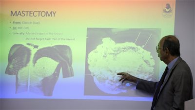 وزارة الصحة تستقدم خبيرًا مصريًا عالميًا في جراحات أورام الثدي لتدريب الأطباء بمستشفى العاصمة الجديدة