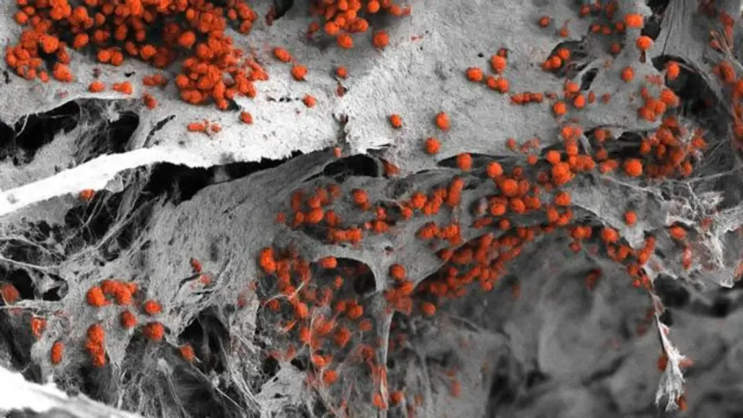 لأول مرة.. تصميم نموذج لنخاع العظم البشري داخل المختبر