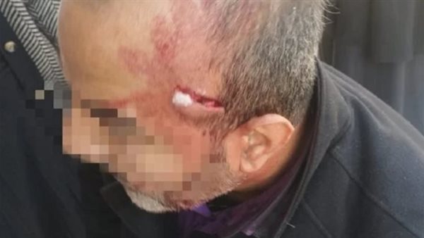 قرار من النيابة بشأن واقعة التعدي على معلم الإسماعيلية بالمقص