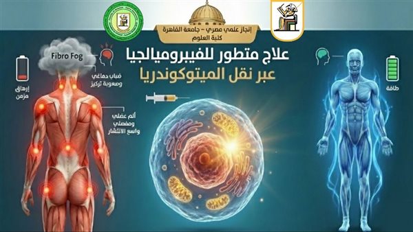 إنجاز علمي جديد يضيء سماء البحث العلمي في جامعة القاهرة لعلاج أحد الأمراض المستعصية “الفيبروميالجيا”