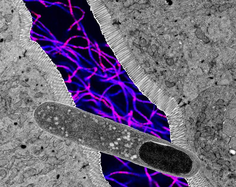 اكتشاف بكتيريا أمعاء تخفض سكر الدم