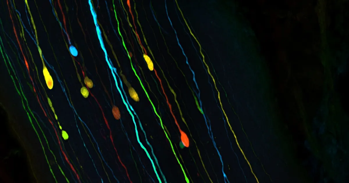 باحثون يتوصلون لأسباب تعافي الجهاز البصري بعد إصابات الدماغ