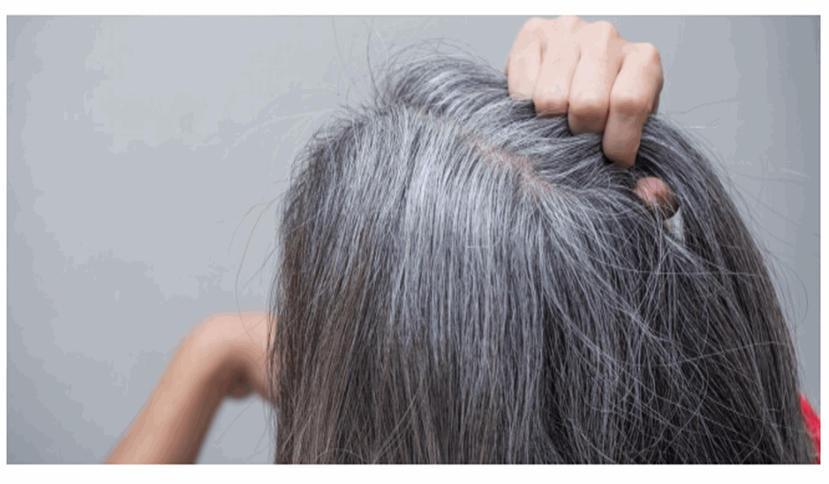 لا تنفق الكثير على الصبغات.. وصفات طبيعية فعالة وآمنة للقضاء على الشعر الأبيض نهائياً