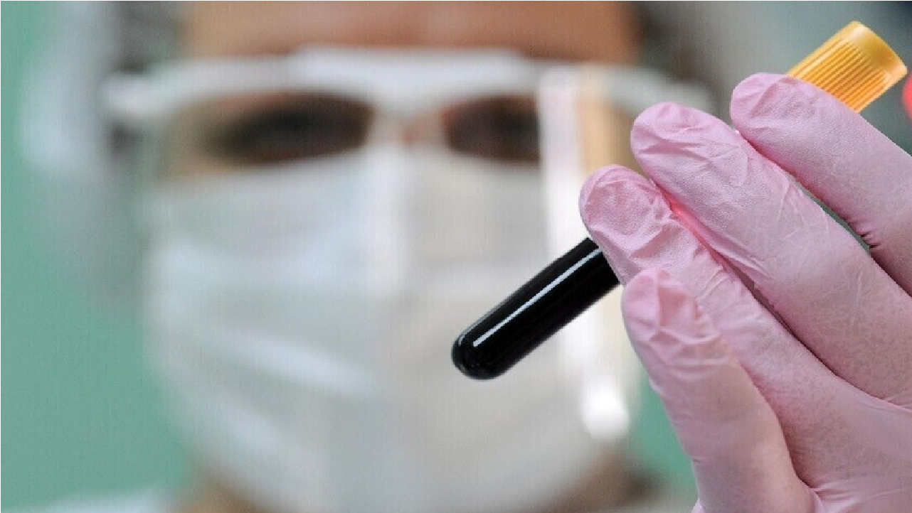 علماء يكتشفون فيروسا صامتا يهدد الجهاز التنفسي ويحذرون من جائحة عالمية