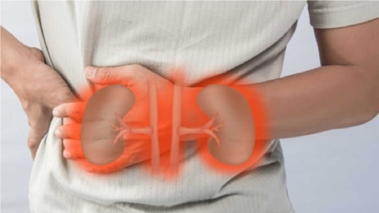 طرق الوقاية من حصى الكلى والتهابات البول أثناء الصيام وتأثير الجفاف على الجسم