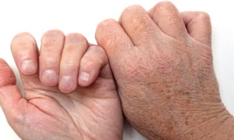 جفاف الجسم خطر حقيقي يهدد الصحة فكيف نحمي أنفسنا؟