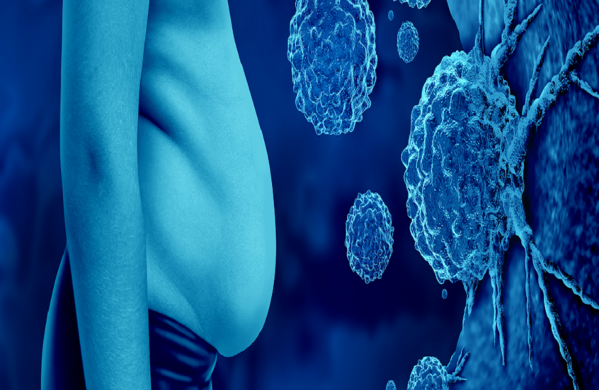 علماء يكشفون عن علاقة مفاجئة بين مستويات الفيتامينات والسمنة والسرطان