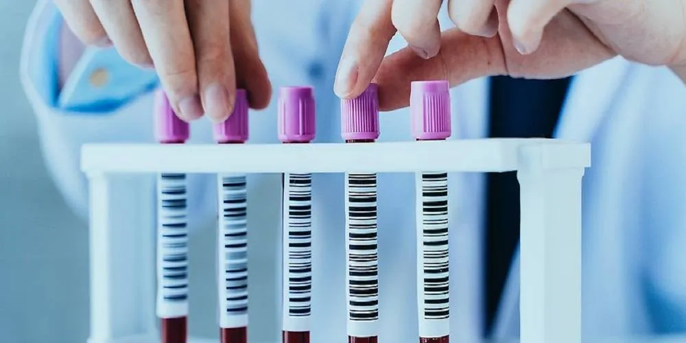 تحليل دم بالذكاء الاصطناعي يقدم قفزة نوعية في كشف أنواع الخرف مبكرًا