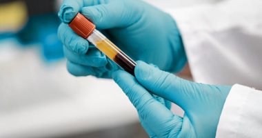 تطعيمات الحج الأساسية ونصائح طبية لسلامة الحجاج