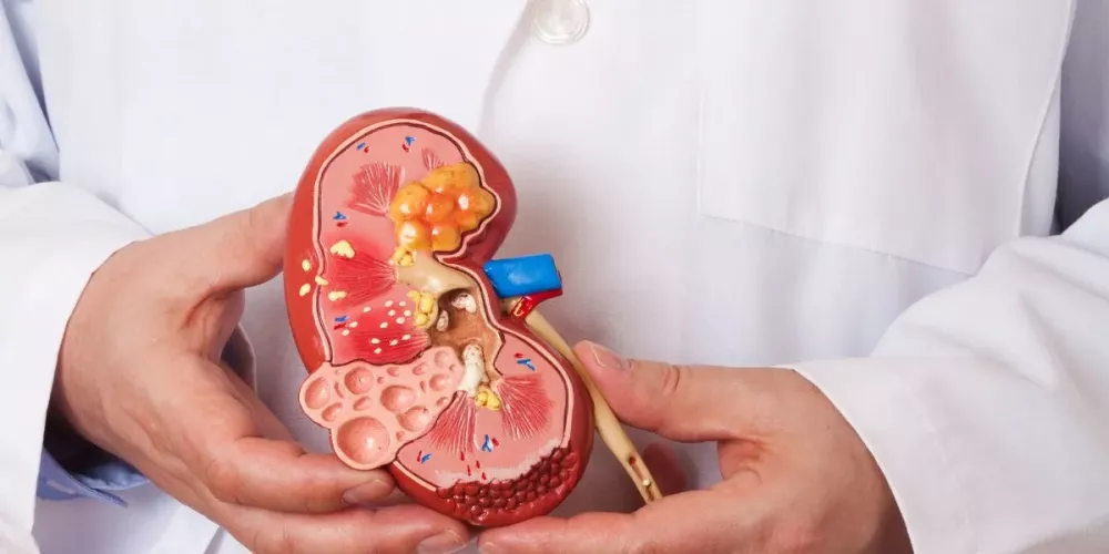 خبير طب حالات حرجة يحذر: عادة يومية شائعة تدمر الكلى بصمت