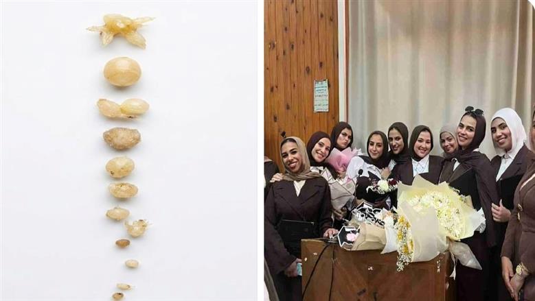 طالبات زراعة الزقازيق ينجحن بإنتاج 3 أصناف بطاطس خالية من الفيروسات