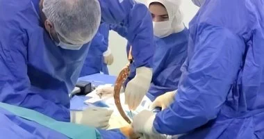 طوارئ صحة كفر الشيخ تنقذ طفلًا من إصابة خطيرة بمستشفى دسوق العام